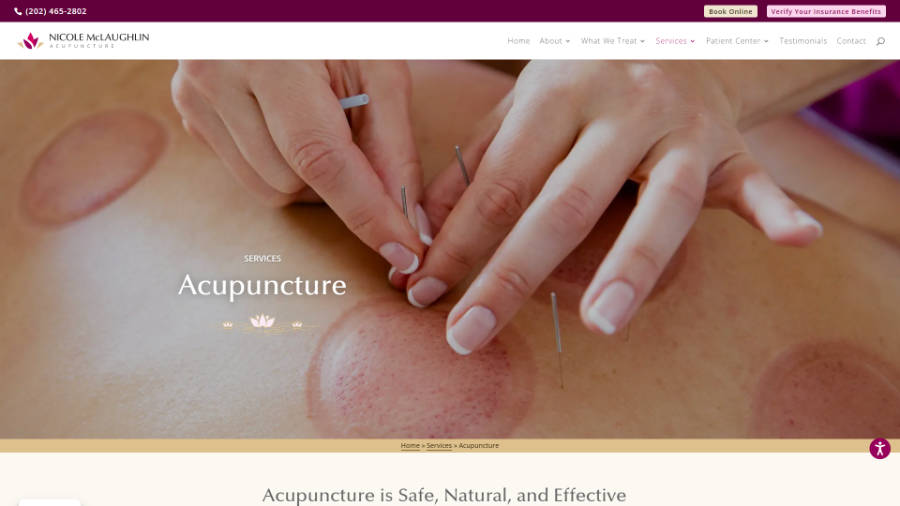 Desktop screenshot of Nicole McLaughlin Acupuncture - Acupuncture page - splash header