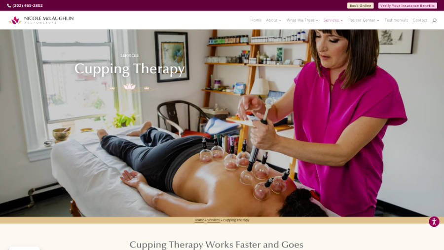 Desktop screenshot of Nicole McLaughlin Acupuncture - Cupping Therapy page - splash header
